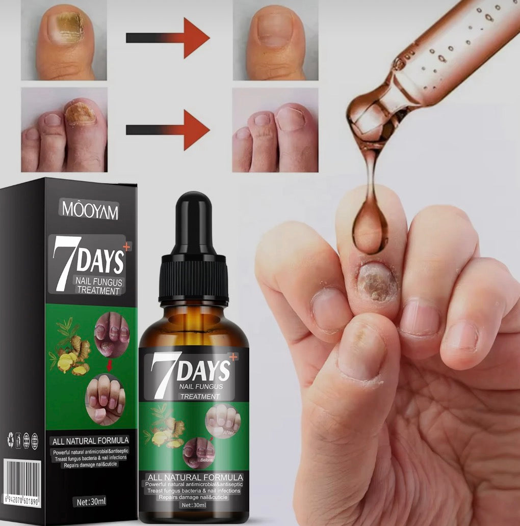 7 DAYS TRATAMIENTO PARA HONGOS UÑAS - PIES Y MANOS 30 ML