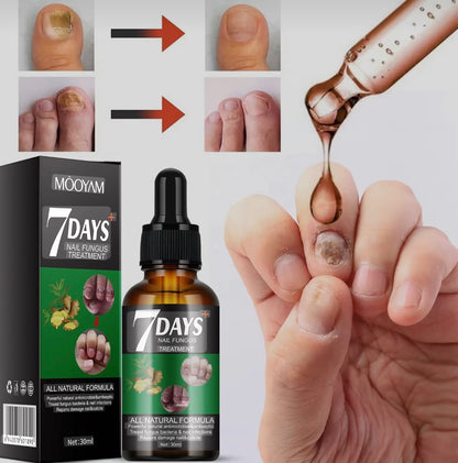 7 DAYS TRATAMIENTO PARA HONGOS UÑAS - PIES Y MANOS 30 ML