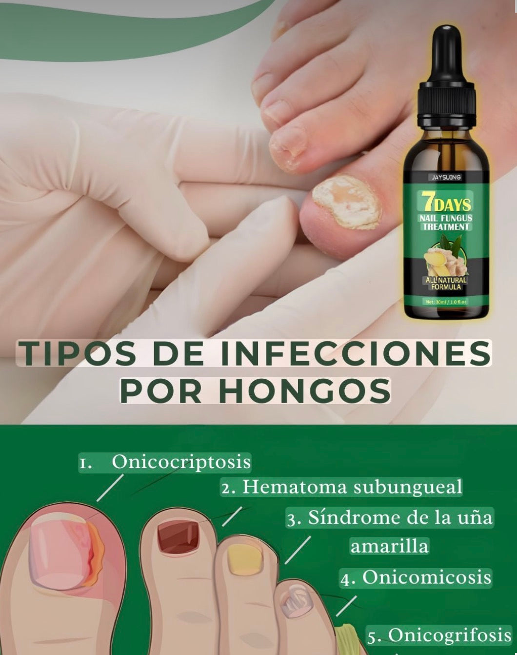 7 DAYS TRATAMIENTO PARA HONGOS UÑAS - PIES Y MANOS 30 ML